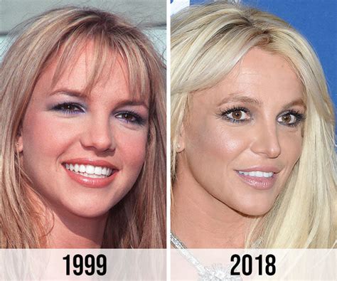 Britney Spears Nose Job 